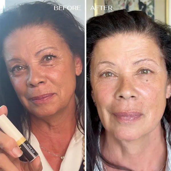 ALL-IN-ONE BALM FOR UNDER EYE RENEWAL✨