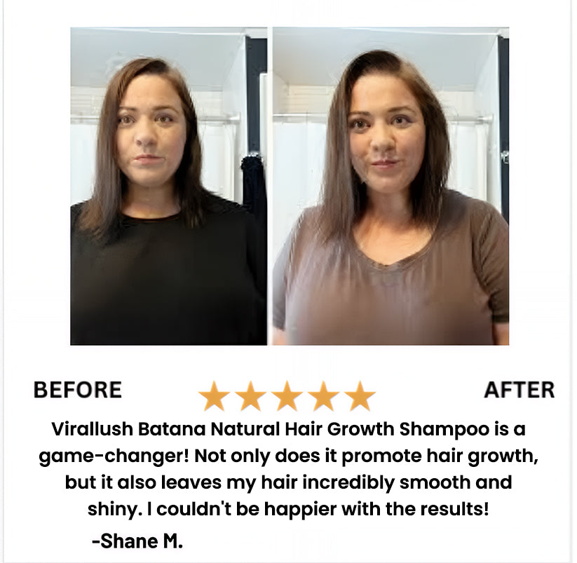 Batana Natural Hair Growth Shampoo