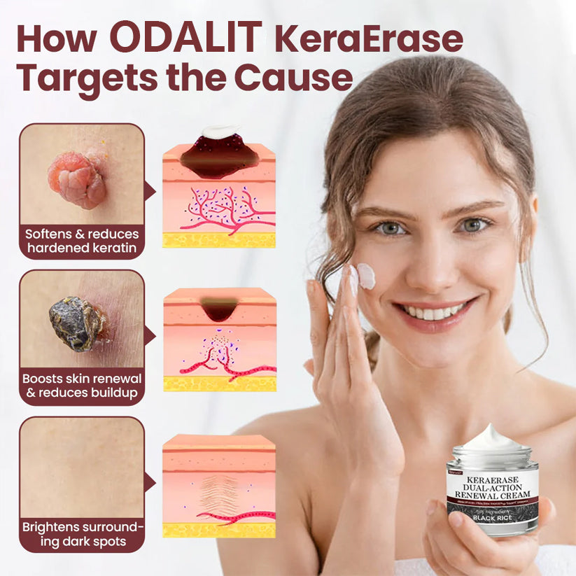 ✅Flash Sale - KeraErase Dual-Action Renewal Cream