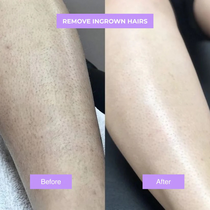 Viralaluna™ - Cyperus Rotundus Skin Serum