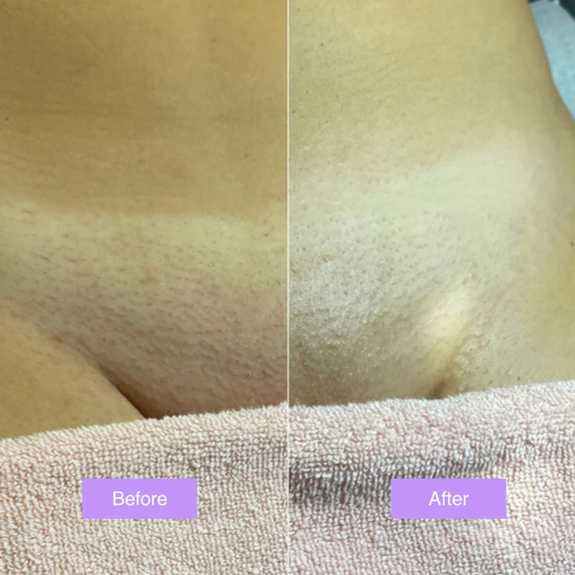 Viralaluna™ - Cyperus Rotundus Skin Serum