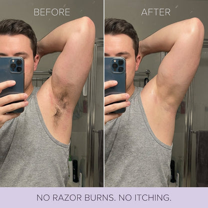 Viralaluna Hair Removal Mousse
