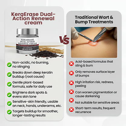 ✅Flash Sale - KeraErase Dual-Action Renewal Cream