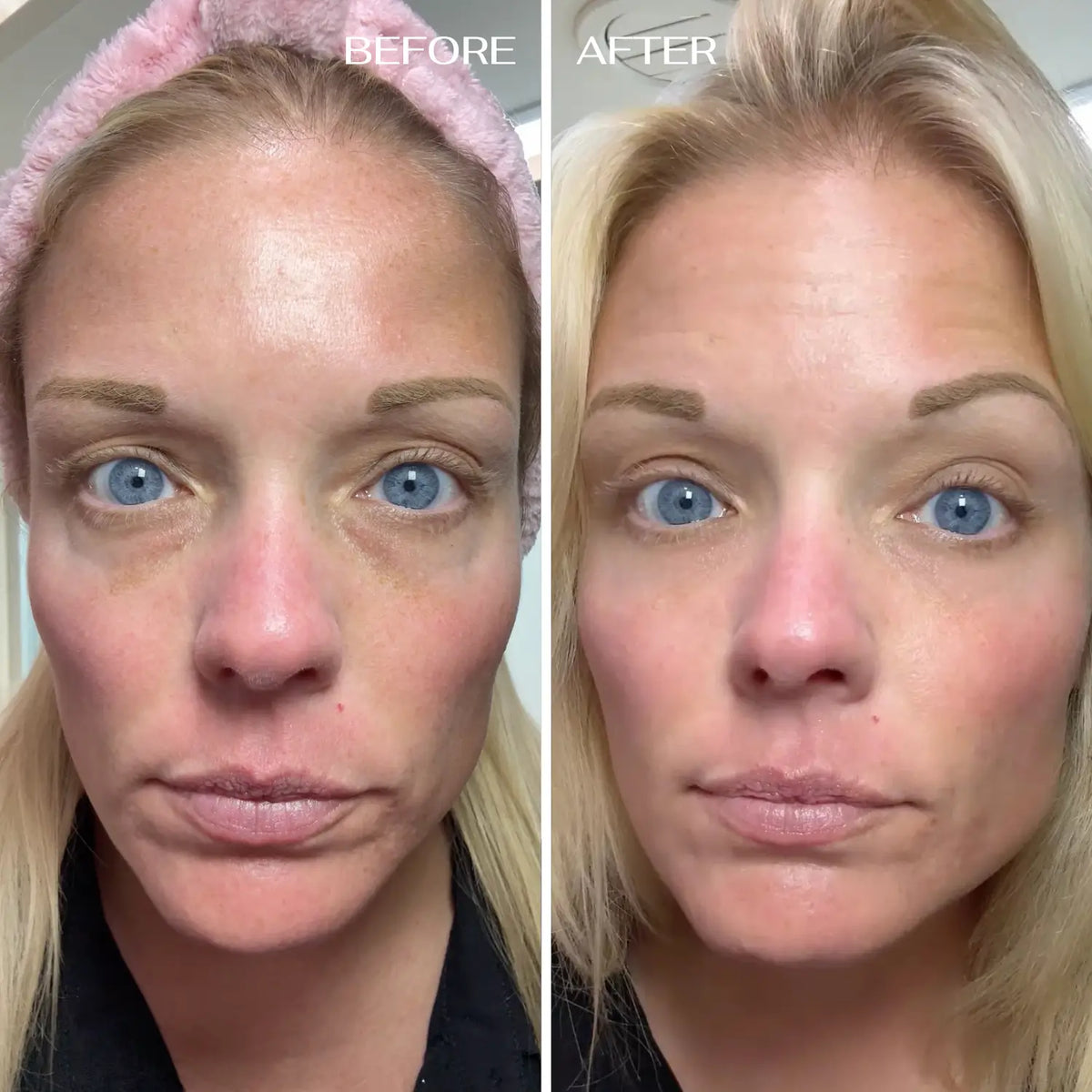 ALL-IN-ONE BALM FOR UNDER EYE RENEWAL✨