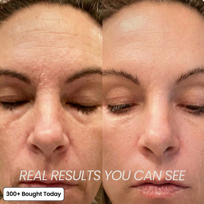 Transform Wrinkles, Fine Lines, And Tired Creases Naturally✨