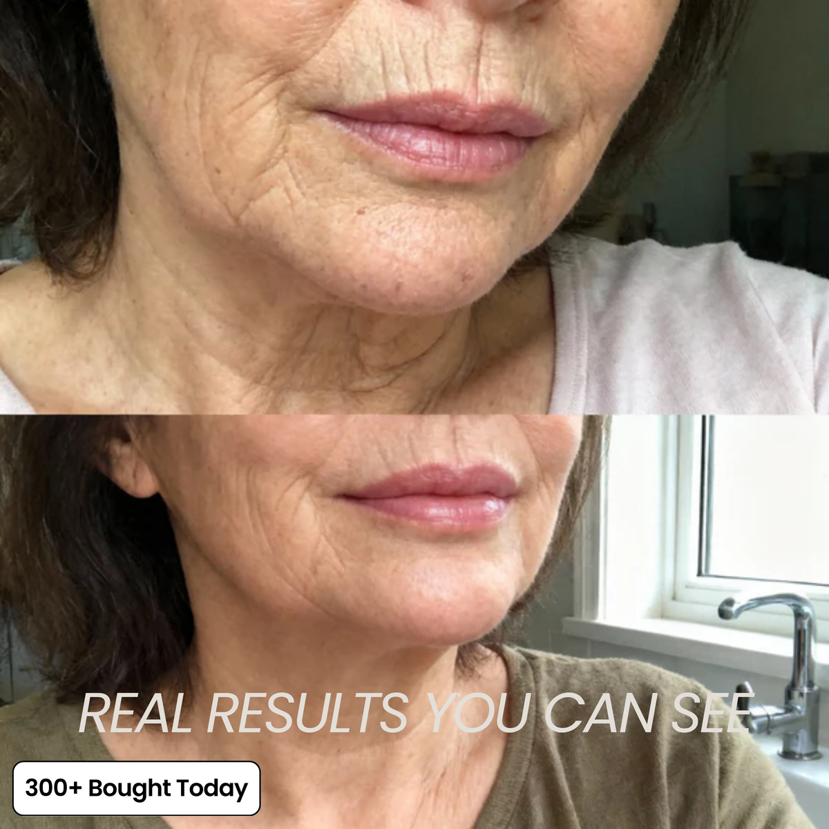 Transform Wrinkles, Fine Lines, And Tired Creases Naturally✨