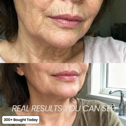 Transform Wrinkles, Fine Lines, And Tired Creases Naturally✨