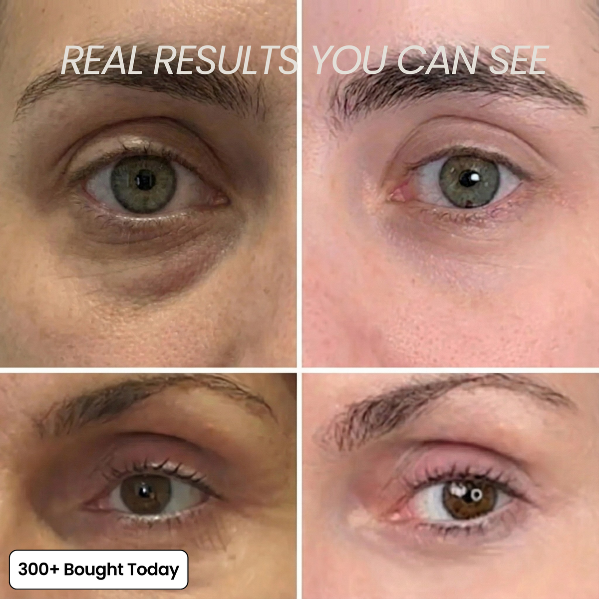 Transform Wrinkles, Fine Lines, And Tired Creases Naturally✨