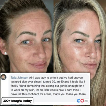 Transform Wrinkles, Fine Lines, And Tired Creases Naturally✨