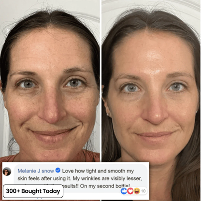 Transform Wrinkles, Fine Lines, And Tired Creases Naturally✨