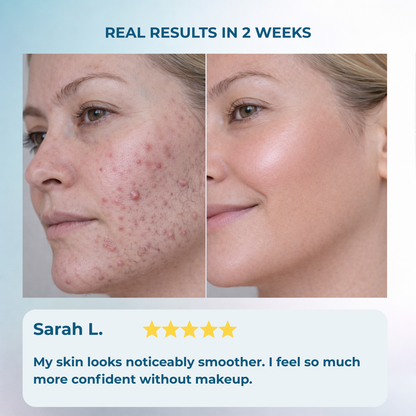 Painless Hormonal Hair Remover - No Redness, No Thicker Regrowth
