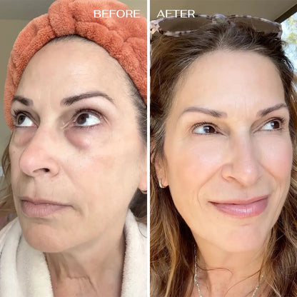 ALL-IN-ONE BALM FOR UNDER EYE RENEWAL✨